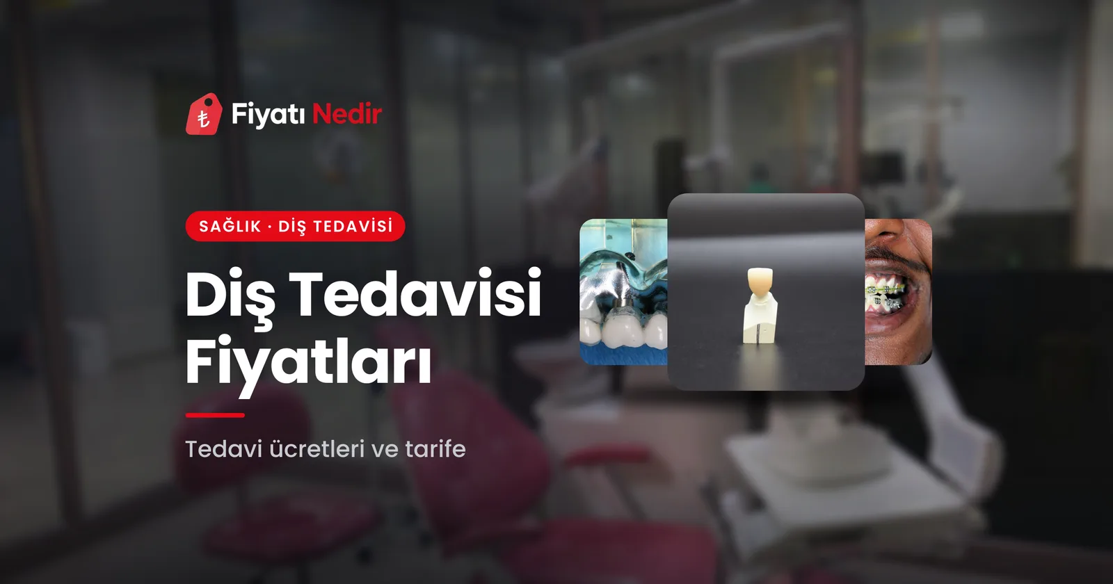 Diş tedavisi fiyatları