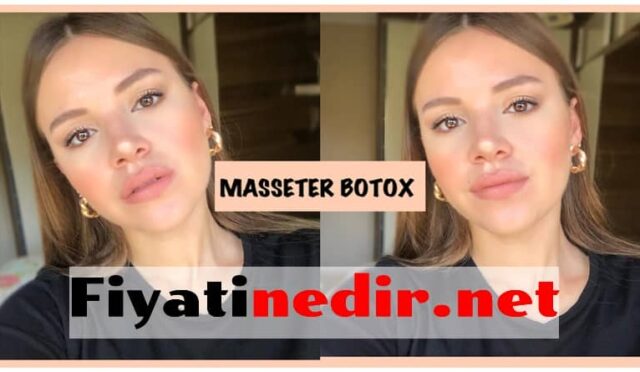 Masseter Botoks Fiyat