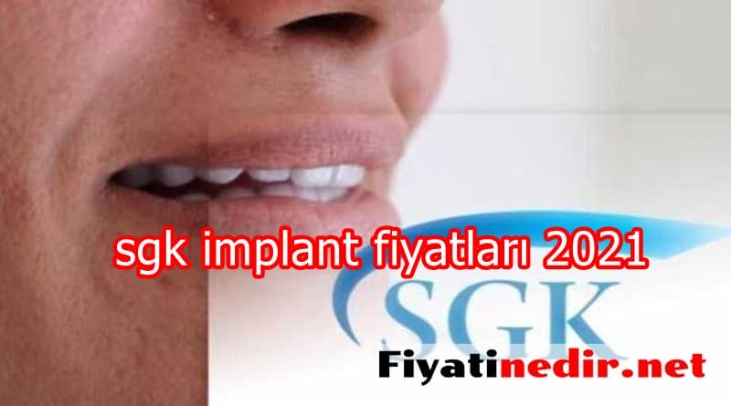 sgk implant fiyatları 2022