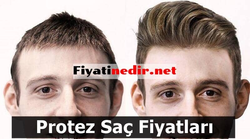 Protez Sac Fiyatlari Fiyati Nedir 2021 Guncel Fiyatlar Protez Sac Fiyatlari Fiyati Nedir 2021 Guncel Fiyatlar