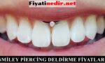 smiley piercing deldirme fiyatları