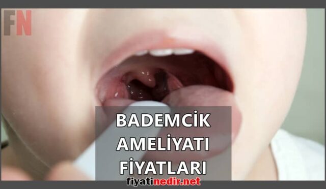 Bademcik Ameliyatı Fiyatları