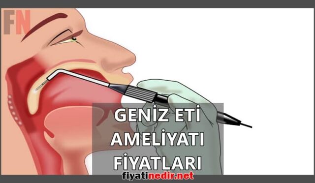 Geniz Eti Ameliyatı Fiyatları