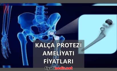 Kalça Protezi Ameliyatı Fiyatları