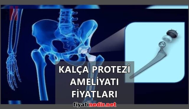 Kalça Protezi Ameliyatı Fiyatları