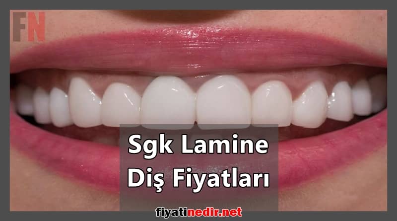 sgk lamine diş fiyatları