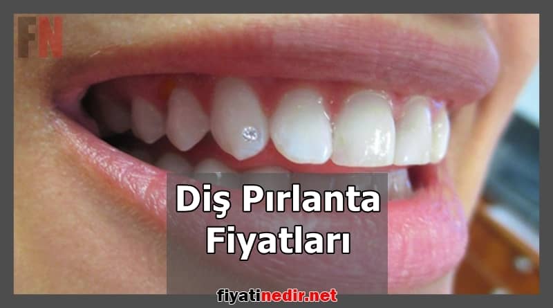 Diş Pırlanta Fiyatları