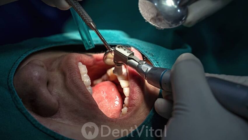 DentVital’in Yeni Adresinde Sunulan Gelişmiş Diş Sağlığı Hizmetleri