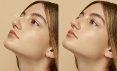 Burun Estetiği Nedir Faydaları Nelerdir