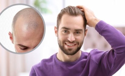 Güvenilir Bir Saç Ekimi Kliniği Nasıl Seçilir?