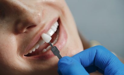 Zirkonyum Diş Kaplamada Dentvital’i Tercih Etmeniz İçin 10 Neden
