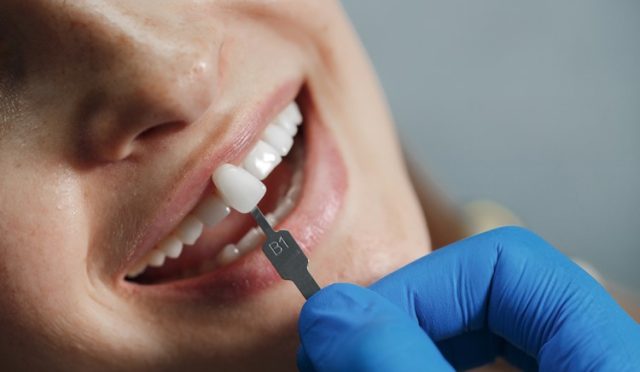Zirkonyum Diş Kaplamada Dentvital’i Tercih Etmeniz İçin 10 Neden 8 Zirkonyum Diş Kaplamada Dentvital’i Tercih Etmeniz İçin 10 Neden