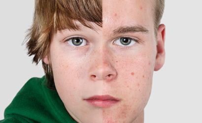 Çocuklarda Erken Ergenlik: Dr. Seren Korkmaz'dan Bilinçli Ailelere Rehber