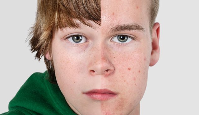 Çocuklarda Erken Ergenlik: Dr. Seren Korkmaz'dan Bilinçli Ailelere Rehber