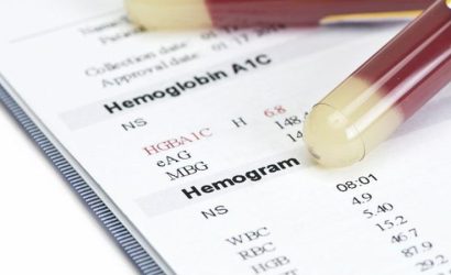 Diyet Öncesi Kan Tahlili: Sağlıklı Bir Başlangıcın Anahtarı