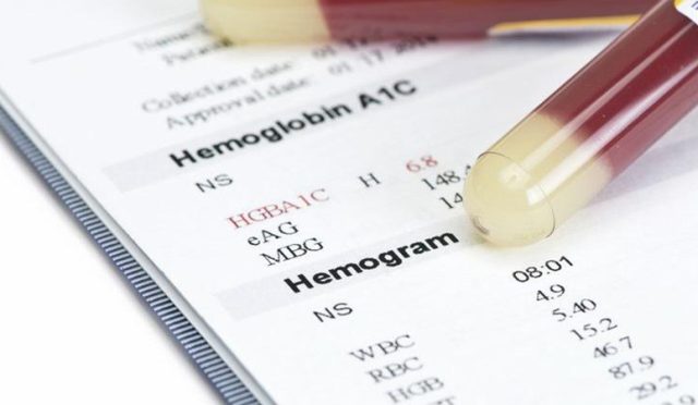 Diyet Öncesi Kan Tahlili: Sağlıklı Bir Başlangıcın Anahtarı