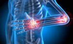 Dr. Seren’den: Güçlü Kemikler İçin Diyet Sırları – Osteoporoza Karşı Kalkanınız!
