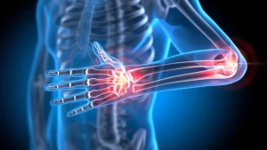 Dr. Seren’den: Güçlü Kemikler İçin Diyet Sırları – Osteoporoza Karşı Kalkanınız!