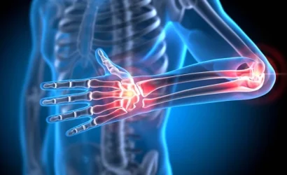 Dr. Seren’den: Güçlü Kemikler İçin Diyet Sırları – Osteoporoza Karşı Kalkanınız!