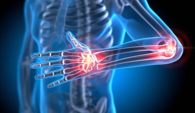 Dr. Seren’den: Güçlü Kemikler İçin Diyet Sırları – Osteoporoza Karşı Kalkanınız!