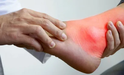 Gut Hastalığında Doğru Beslenme: Ürik Asit Kontrolü ve Sağlıklı Bir Yaşam