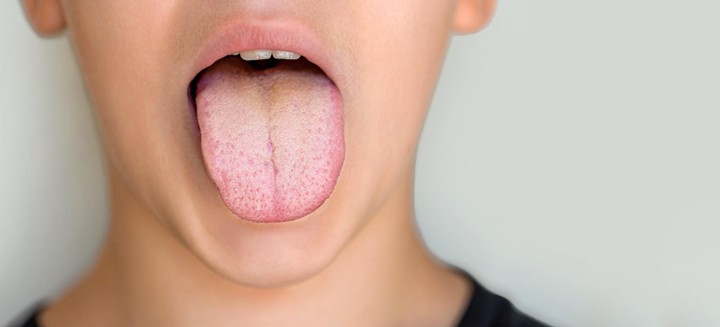 Candida Hastalığı ve Beslenme Tedavisi: Dr. Seren'den Kapsamlı Rehber 1 Candida Enfeksiyonu Vücudunuzdaki Sinyaller Neler