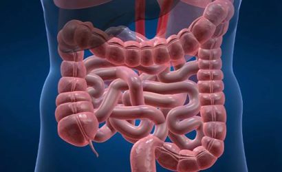 Geçirgen Bağırsak Sendromu: Bilmeniz Gerekenler ve İyileşme Yolları