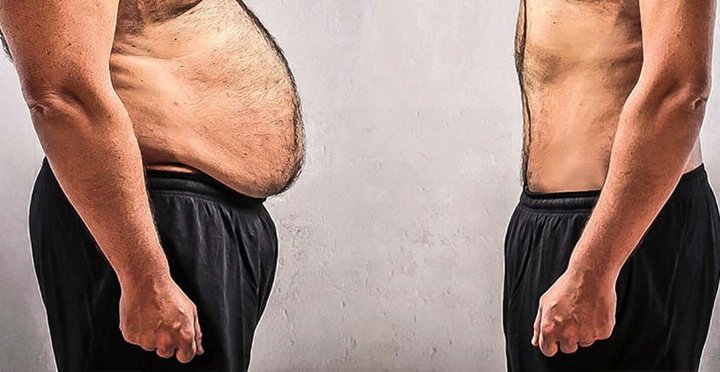 Karın Yağları Neden Bu Kadar İnatçı? Bilimsel Bakış Açısı